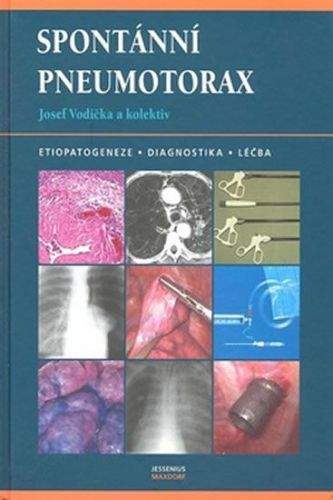 Josef Vodička: Spontánní pneumotorax