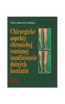 Július Mazuch: Chirurgické aspekty chronickej venóznej insuficiencie dolných končatín