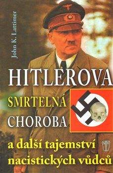 John Lattimer: Hitlerova smrtelná choroba a další tajemství nacistických vůdců
