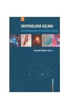 Jaromír Šimša: Sentinelová uzlina