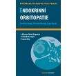 Endokrinní orbitopatie