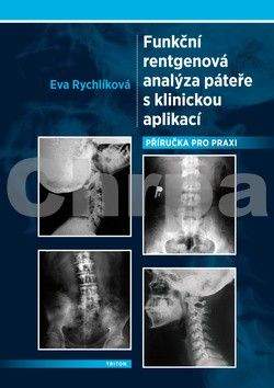 Eva Rychlíková: Funkční rentgenová analýza páteře s klinickou aplikací