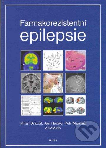 Triton Farmakorezistentní epilepsie - Milan Brázdil, Jan Hadač, Petr Marusič, kolektiv