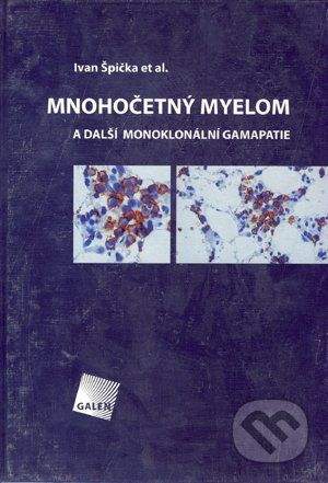 Galén Mnohočetný myelom - Ivan Špička et al.