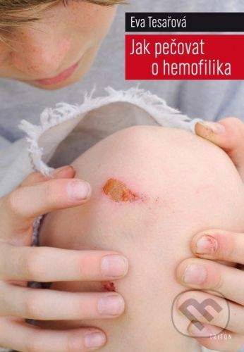 Tesařová Eva MUDr.: Jak pečovat o hemofilika