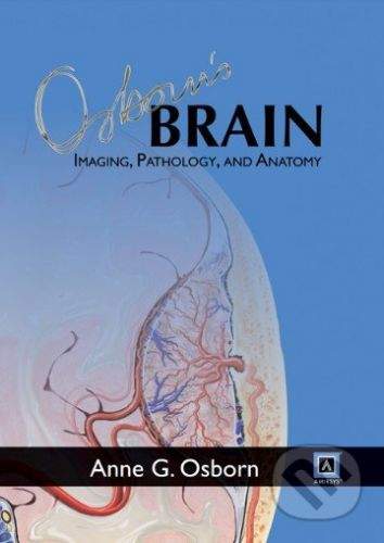 Lippincott Williams & Wilkins Osborn's Brain: Imaging, Pathology, and Anatomy - Anne G. Osborn
