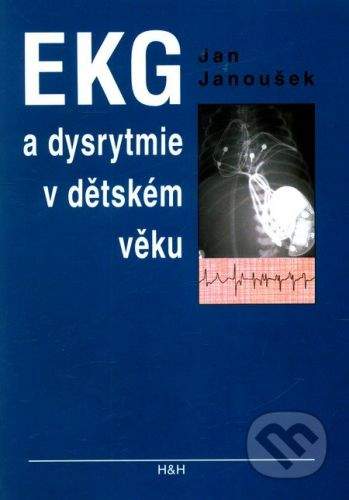 Jan Janoušek: EKG a dysrytmie v dětském věku (Praktický návod k diagnostice a léčbě)