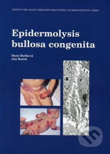Národní centrum ošetrovatelství Epidermolysis bullosa congenita - Hana Bučková, Jan Buček