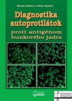 Marián Benčat, Július Rajčáni: Diagnostika autoprotilátok proti antigénom bunkového jadra