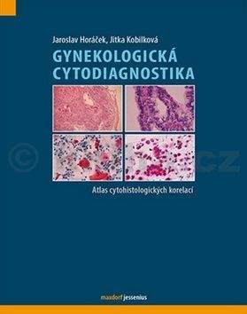 Jaroslav Horáček, Jitka Kobilková: Gynekologická cytodiagnostika