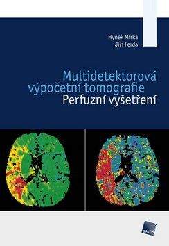 Jiří Ferda, Hynek Mírka: Multidetektorová výpočetní tomografie