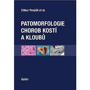 Galén Patomorfologie chorob kostí a kloubů