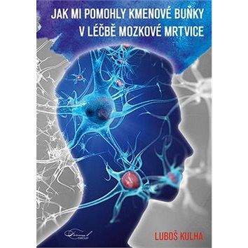 Formal group Jak mi pomohly kmenové buňku v léčbě mozkové mrtvice