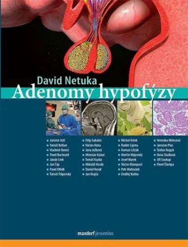 David Netuka: Adenomy hypofýzy