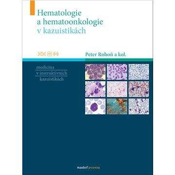 Peter Rohoň: Hematologie a hematoonkologie v kazuistikách