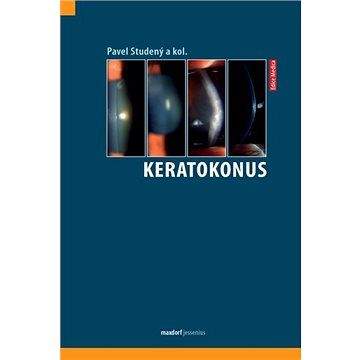 Pavel Studený: Keratokonus