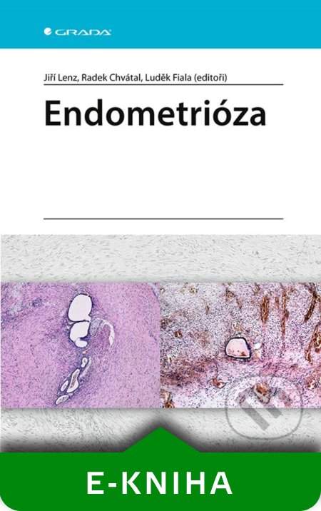 Endometrióza, Lenz Jiří