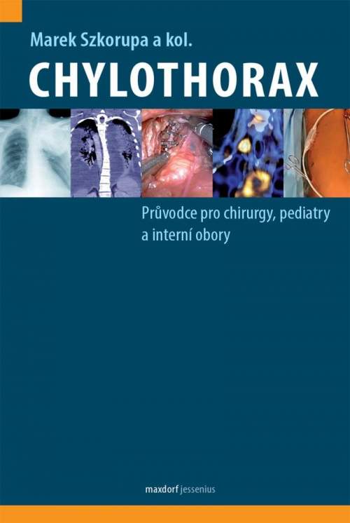 Chylothorax - Průvodce pro chirurgy, pediatry a interní obory - Szkorupa Marek