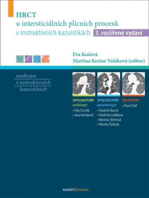 HRCT u intersticiálních plicních procesů v instruktivních kazuistikách - Martina Koziar Vašáková