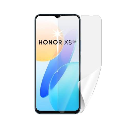 Screenshield pro Honor X8 5G HUA-HONX85G-D