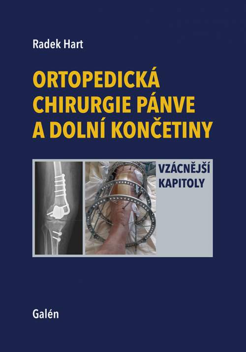 Ortopedická chirurgie pánve a dolní končetiny - Vzácnější kapitoly - Radek Hart
