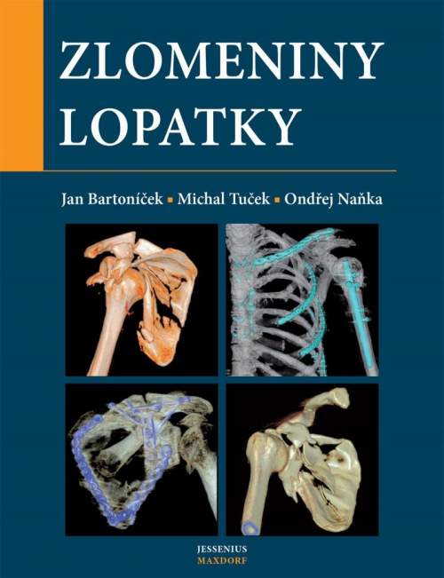 Jan Bartoníček, Michal Tuček, Ondřej Naňka - Zlomeniny lopatky