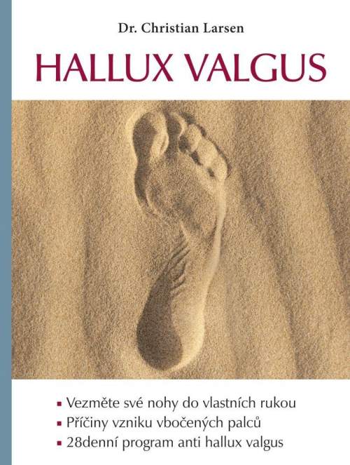 Hallux valgus - Christian Larsen