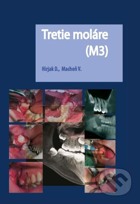 Tretie moláre (M3) - Vladimír Machoň