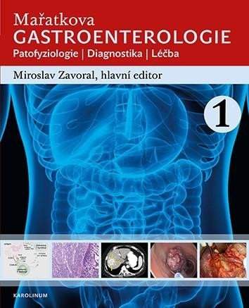 Miroslav Zavoral - Mařatkova gastroenterologie