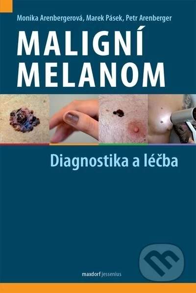 Maligní melanom - Diagnostika a léčba - Monika Arenbergerová