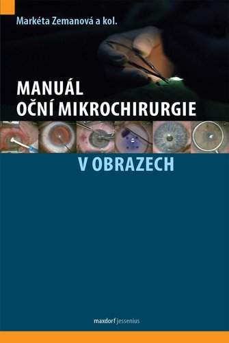 Manuál oční mikrochirurgie v obrazech - Markéta Zemanová, kolektiv autorů