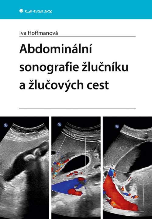 Abdominální sonografie žlučníku a žlučových cest - Iva Hoffmanová