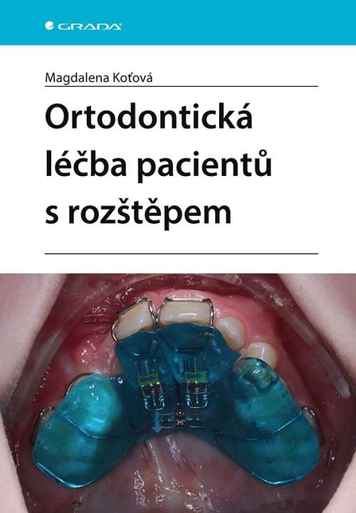 Ortodontická léčba pacientů s rozštěpem - Koťová Magdalena