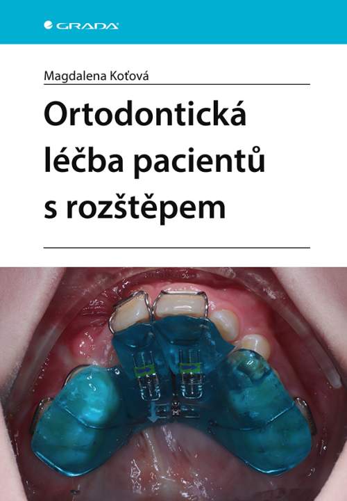 Magdalena Koťová - Ortodontická léčba pacientů s rozštěpem -