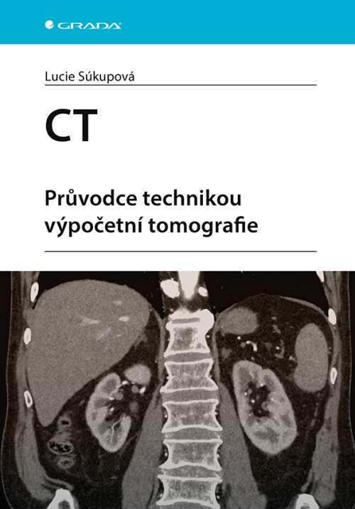 GRADA CT - Průvodce technikou výpočetní tomografie, Súkupová Lucie